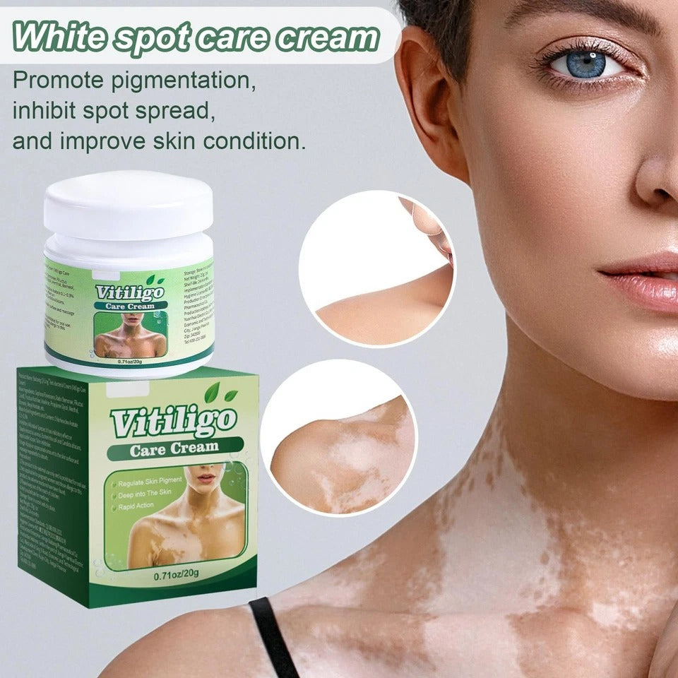 ?  VITILIGO Care Cream - Restore your Natural Beauty (Pack of 2)